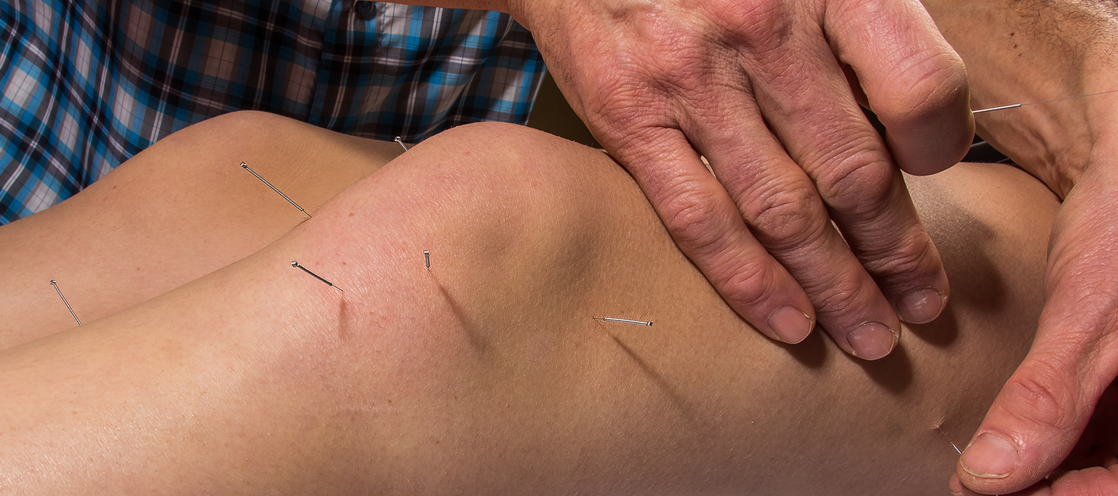 Dry Needles