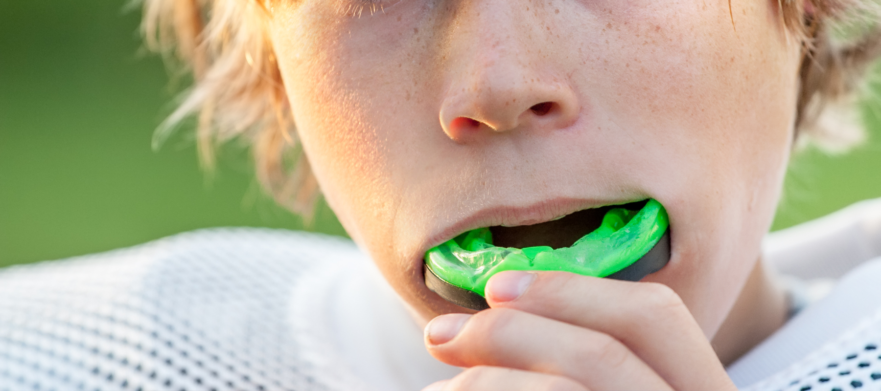 Mouth Guards