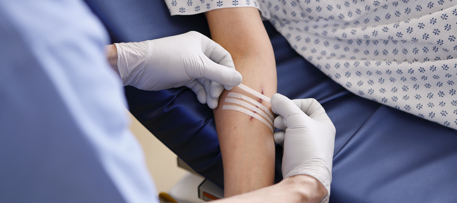 Wound Closure